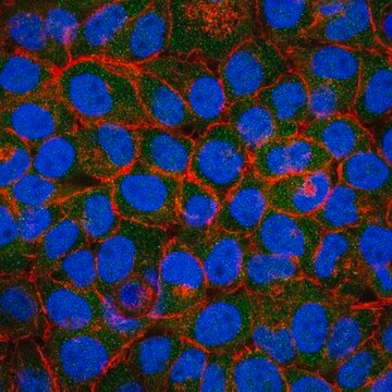 Anti-ICAT Antibody from rabbit, purified by affinity chromatography