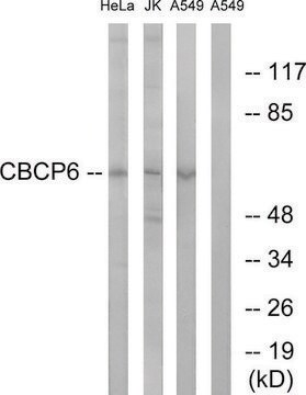 Anti-AGBL4 antibody produced in rabbit affinity isolated antibody