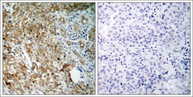 Anti-IGF1R (Ab-1161) antibody produced in rabbit affinity isolated antibody