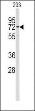 ANTI-CEA (CENTER) antibody produced in rabbit purified immunoglobulin, buffered aqueous solution