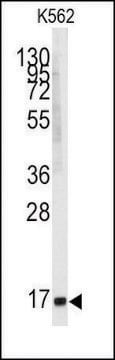 Anti-ANGEL2 (center) antibody produced in rabbit saturated ammonium sulfate (SAS) precipitated, buffered aqueous solution