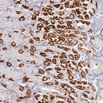 Anti-DHX34 antibody produced in rabbit Prestige Antibodies&#174; Powered by Atlas Antibodies, affinity isolated antibody, buffered aqueous glycerol solution