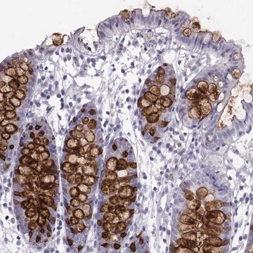 Anti-ITLN1 antibody produced in rabbit Prestige Antibodies&#174; Powered by Atlas Antibodies, affinity isolated antibody