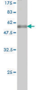 Monoclonal Anti-TPMT antibody produced in mouse clone 2H3, purified immunoglobulin, buffered aqueous solution