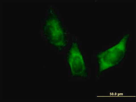 Anti-DARS antibody produced in mouse purified immunoglobulin, buffered aqueous solution