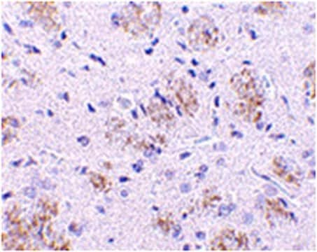 Anti-KLHL1 Antibody from rabbit, purified by affinity chromatography