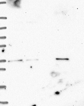 Anti-ETV1 antibody produced in rabbit Prestige Antibodies&#174; Powered by Atlas Antibodies, affinity isolated antibody, buffered aqueous glycerol solution