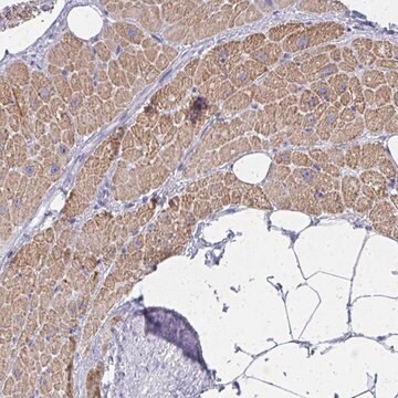 Anti-ZNF805 antibody produced in rabbit Prestige Antibodies&#174; Powered by Atlas Antibodies, affinity isolated antibody, buffered aqueous glycerol solution