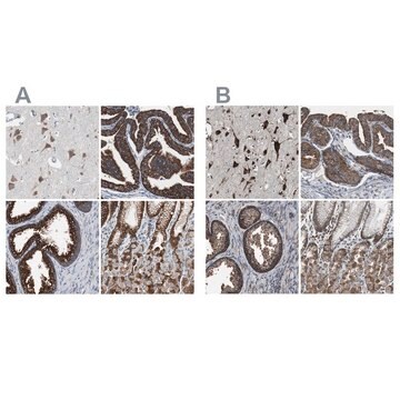 Anti-USP10 antibody produced in rabbit Ab2, Prestige Antibodies&#174; Powered by Atlas Antibodies, affinity isolated antibody, buffered aqueous glycerol solution