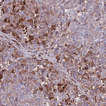 Anti-SLC25A16 antibody produced in rabbit Prestige Antibodies&#174; Powered by Atlas Antibodies, affinity isolated antibody, buffered aqueous glycerol solution