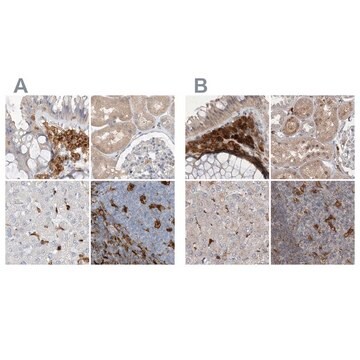 Anti-NAGK antibody produced in rabbit Prestige Antibodies&#174; Powered by Atlas Antibodies, affinity isolated antibody, buffered aqueous glycerol solution