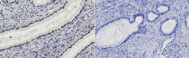 Anti-SIX1 Antibody, clone 1M23 ZooMAb&#174; Rabbit Monoclonal recombinant, expressed in HEK 293 cells