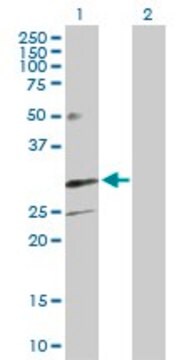 Anti-TREM1 antibody produced in rabbit purified immunoglobulin, buffered aqueous solution