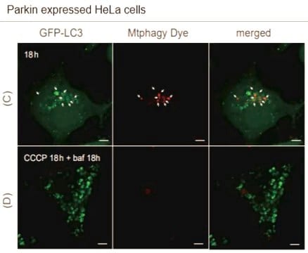 BioTracker&#8482; Mitophagy Live Cell Probe