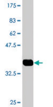 Monoclonal Anti-FBLN1 antibody produced in mouse clone 3E4, purified immunoglobulin, buffered aqueous solution