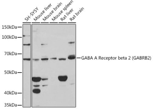 Anti-GABA A Receptor beta 2 (GABRB2) Antibody, clone 6G9O8, Rabbit Monoclonal