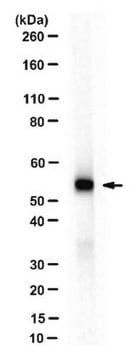 Anti-Pancreatic Lipase/PNLIP Antibody serum, from rabbit