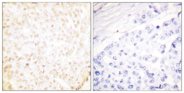 Anti-XRCC5, C-Terminal antibody produced in rabbit affinity isolated antibody