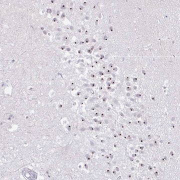 Anti-FAM9A antibody produced in rabbit Prestige Antibodies&#174; Powered by Atlas Antibodies, affinity isolated antibody, buffered aqueous glycerol solution