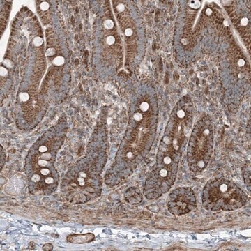 Anti-KY antibody produced in rabbit Prestige Antibodies&#174; Powered by Atlas Antibodies, affinity isolated antibody, buffered aqueous glycerol solution