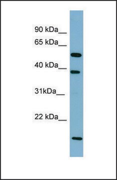 抗 SLC10A1 affinity isolated antibody