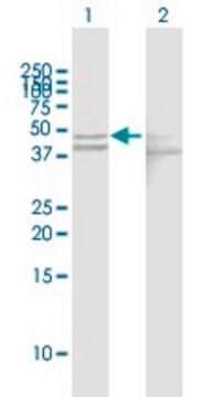 Anti-GOT1 antibody produced in mouse purified immunoglobulin, buffered aqueous solution