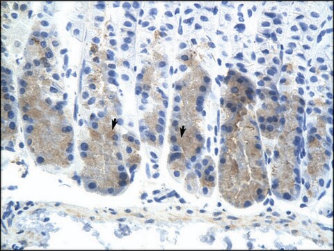 Anti-ELF3 (AB3) antibody produced in rabbit affinity isolated antibody