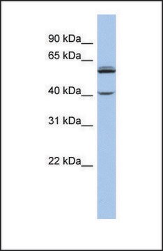 Anti-CYP4V2 antibody produced in rabbit affinity isolated antibody