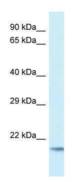 Anti-UBE2V1 (C-terminal) antibody produced in rabbit affinity isolated antibody