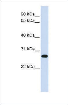 Anti-SNAP23 antibody produced in rabbit affinity isolated antibody