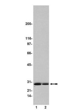 Ral Assay Reagent (Ral BP1, agarose)