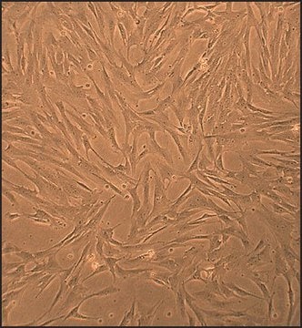 Porcine Pulmonary Artery Smooth Muscle Cells: PPASMC (Cryovial)