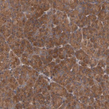 Anti-UBAP1 antibody produced in rabbit Prestige Antibodies&#174; Powered by Atlas Antibodies, affinity isolated antibody, buffered aqueous glycerol solution, Ab2