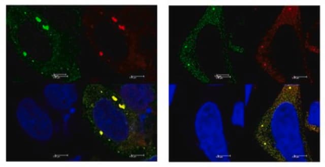 Anti-YTHDF2 Antibody from rabbit, purified by affinity chromatography