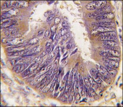 Anti-ST13 (N-term) antibody produced in rabbit IgG fraction of antiserum, buffered aqueous solution