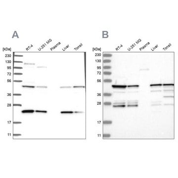 Anti-PPP1R7 antibody produced in rabbit Prestige Antibodies&#174; Powered by Atlas Antibodies, affinity isolated antibody, buffered aqueous glycerol solution