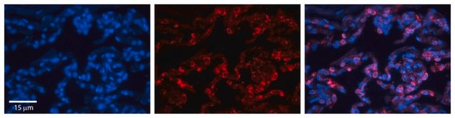 Anti-FOLR1 antibody produced in rabbit affinity isolated antibody