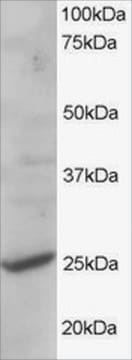 Anti-CYB561D2 antibody produced in goat affinity isolated antibody, buffered aqueous solution