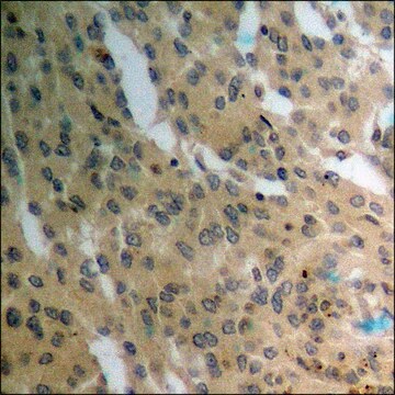 Anti-phospho-PTEN (pSer385) antibody produced in rabbit affinity isolated antibody