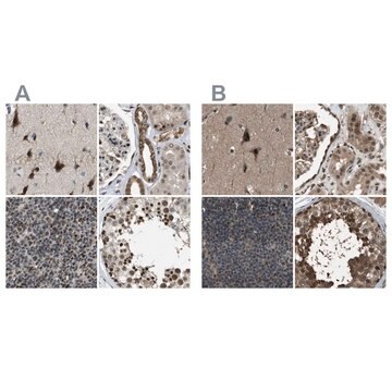 Anti-SERTAD2 antibody produced in rabbit Prestige Antibodies&#174; Powered by Atlas Antibodies, affinity isolated antibody, buffered aqueous glycerol solution, Ab2