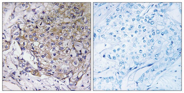 Anti-WASF3 antibody produced in rabbit affinity isolated antibody