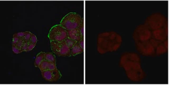 Anti-Androgen Receptor Antibody, Alexa Fluor&#8482; 555 Conjugate from rabbit, ALEXA FLUOR&#8482; 555