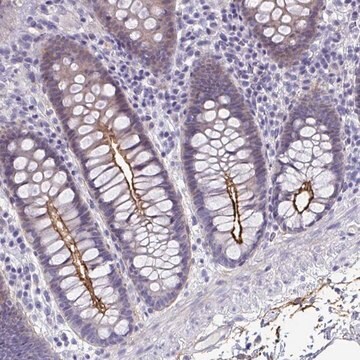 Anti-PIGZ antibody produced in rabbit Prestige Antibodies&#174; Powered by Atlas Antibodies, affinity isolated antibody, buffered aqueous glycerol solution