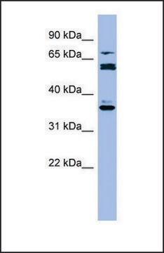 Anti-CYP2B6 antibody produced in rabbit affinity isolated antibody