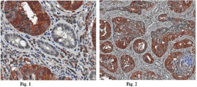 Anticuerpo anti-Atg18 (WIPI-2), clon 2A2 clone 2A2, from mouse