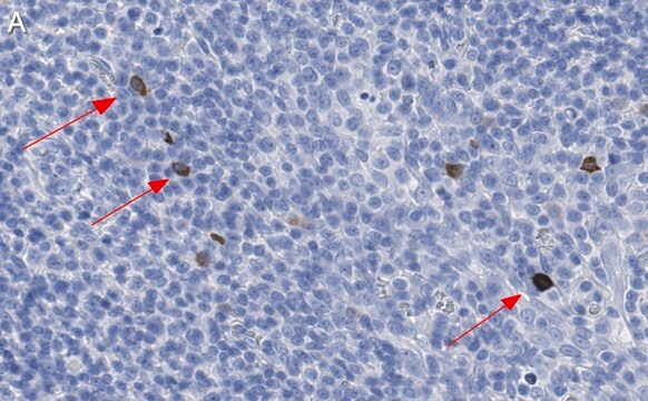 Anti-TNF&#946;/LTA Antibody, clone 3B20-H2 ZooMAb&#174; Rabbit Monoclonal recombinant, expressed in HEK 293 cells