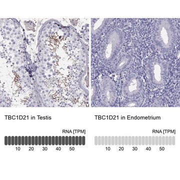 Anti-TBC1D21 antibody produced in rabbit Prestige Antibodies&#174; Powered by Atlas Antibodies, affinity isolated antibody, buffered aqueous glycerol solution