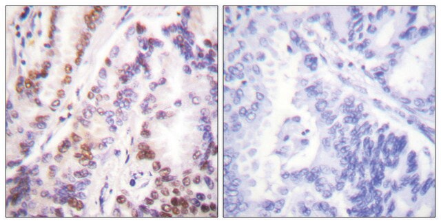 Anti-HDAC9 antibody produced in rabbit affinity isolated antibody