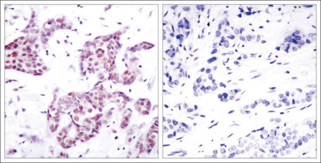 Anti-phospho-STAT6 (pTyr641) antibody produced in rabbit affinity isolated antibody