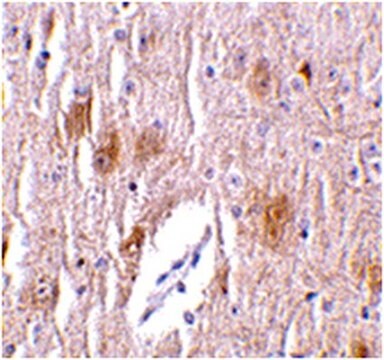 Anti-TRIM5 delta Antibody from rabbit, purified by affinity chromatography